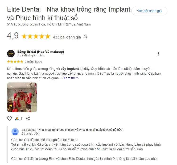 Hình: review trồng răng implant Elite Dental